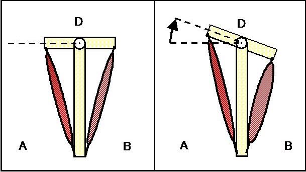 Diagram of muscular imbalance