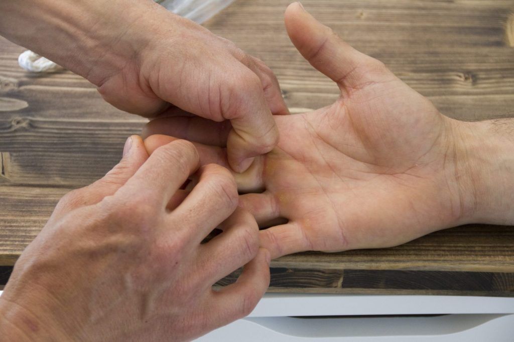 Fingertherapie bei einer Kletterin